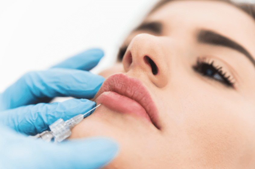 Dealing With Lumps Of Dermal Filler